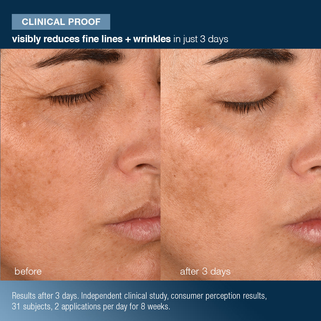 Before and after comparison of skin with text indicating reduction of fine lines and wrinkles.