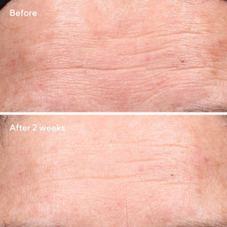 Murad Retinol Youth Renewal Serum