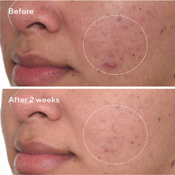 Murad Rapid Dark Spot Correcting Serum