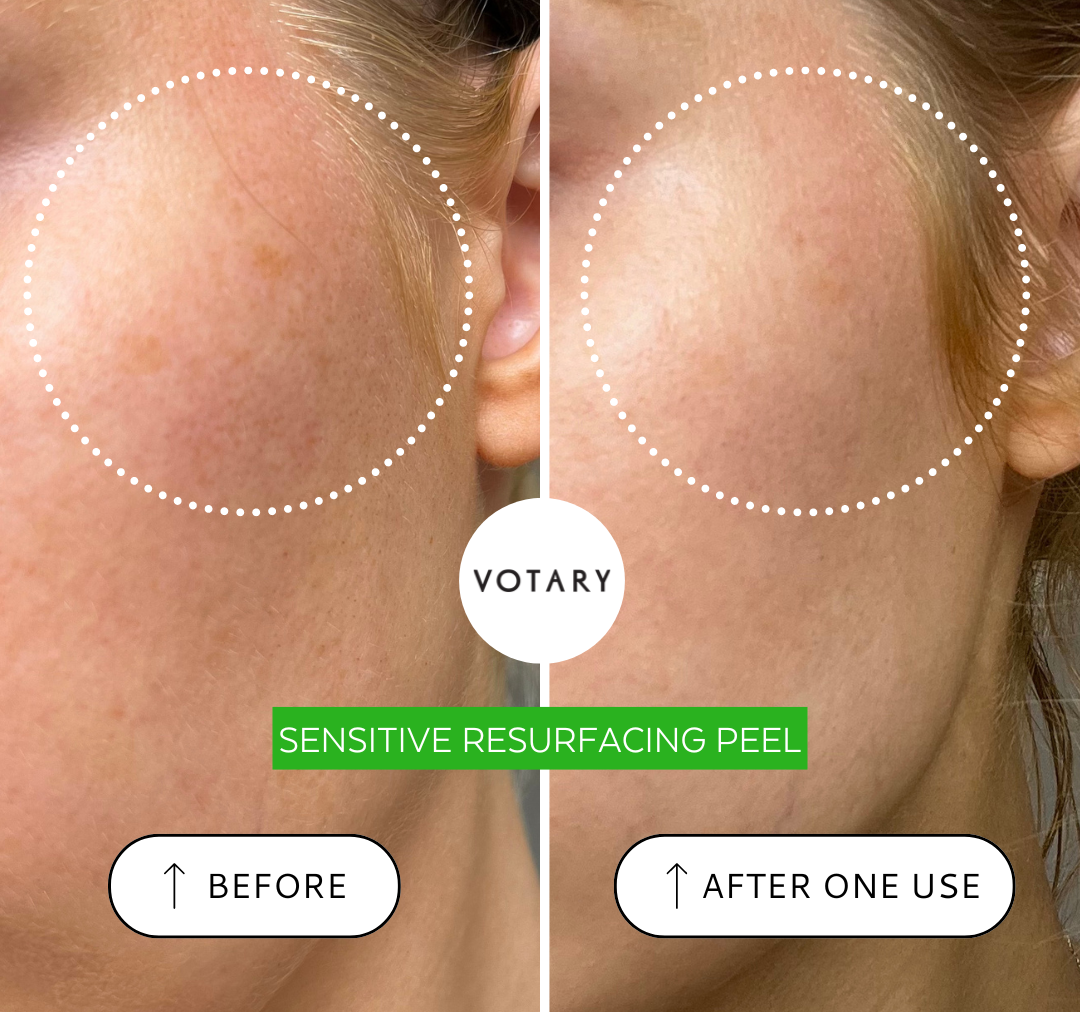 Votary Sensitive Resurfacing Peel, 10% Lactic Acid and Super Seeds 30ml