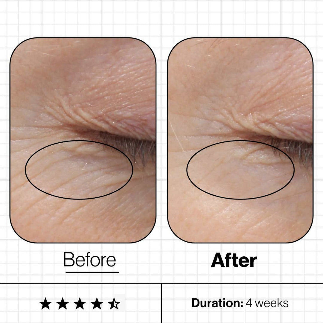 A before and after 4 weeks of using the product showing an improved skin condition