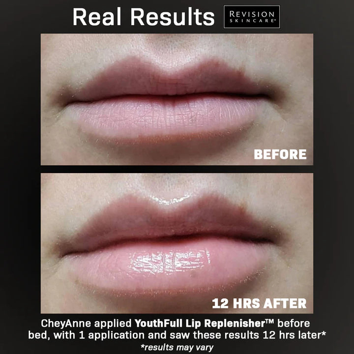 Before and after comparison of lips with Revision Skincare branding, showing a visible improvement 12 hours later.