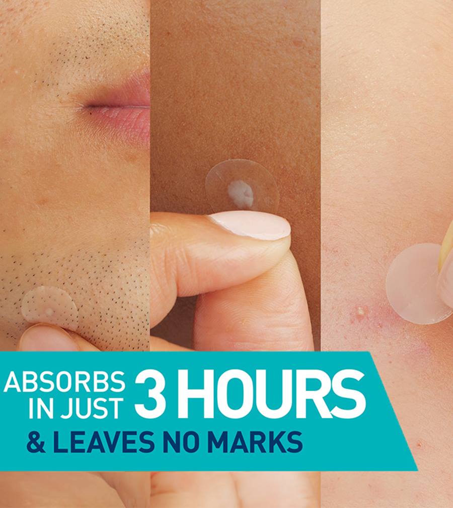 CeraVe Blemish Barrier Patches