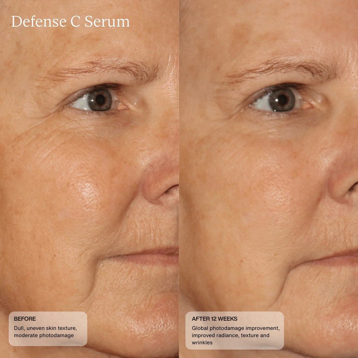 Senté Defense C Serum