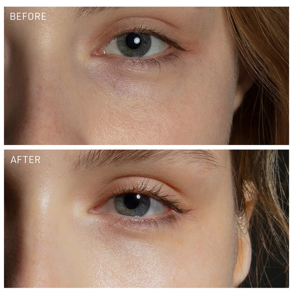 FOREO FAQ Microneedling Anti-Wrinkle Hyaluronic Acid Patches For Under Eyes