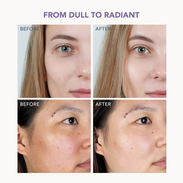 Before and after skin comparison collage showing two women's faces with the text 'FROM DULL TO RADIANT' at the top, demonstrating skincare or cosmetic results.