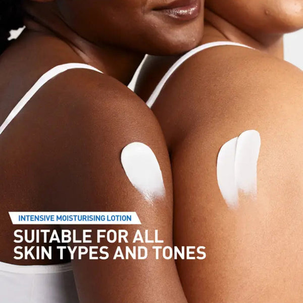 Two people with white lotion patches on their skin, with text about intensive moisturizing lotion suitability for all skin types.
