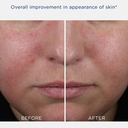NeoStrata Mandelic Clarifying Hydragel