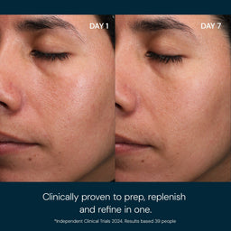 Before and after comparison of a person's face with text indicating clinical provenance.