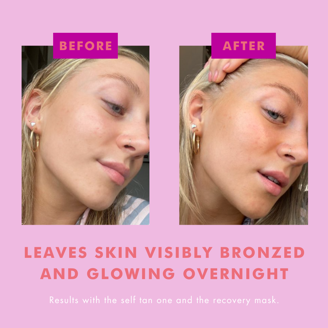 Before and after comparison of a person's face with text on a pink background