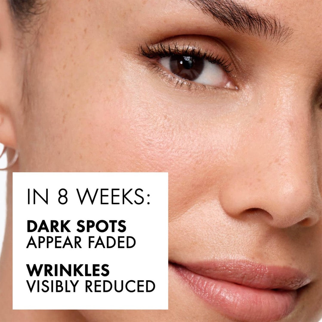 Vichy Liftactiv B3 5% Niacinamide & Aha Complex Dark Spots & Pigmentation Serum 30ml benefits