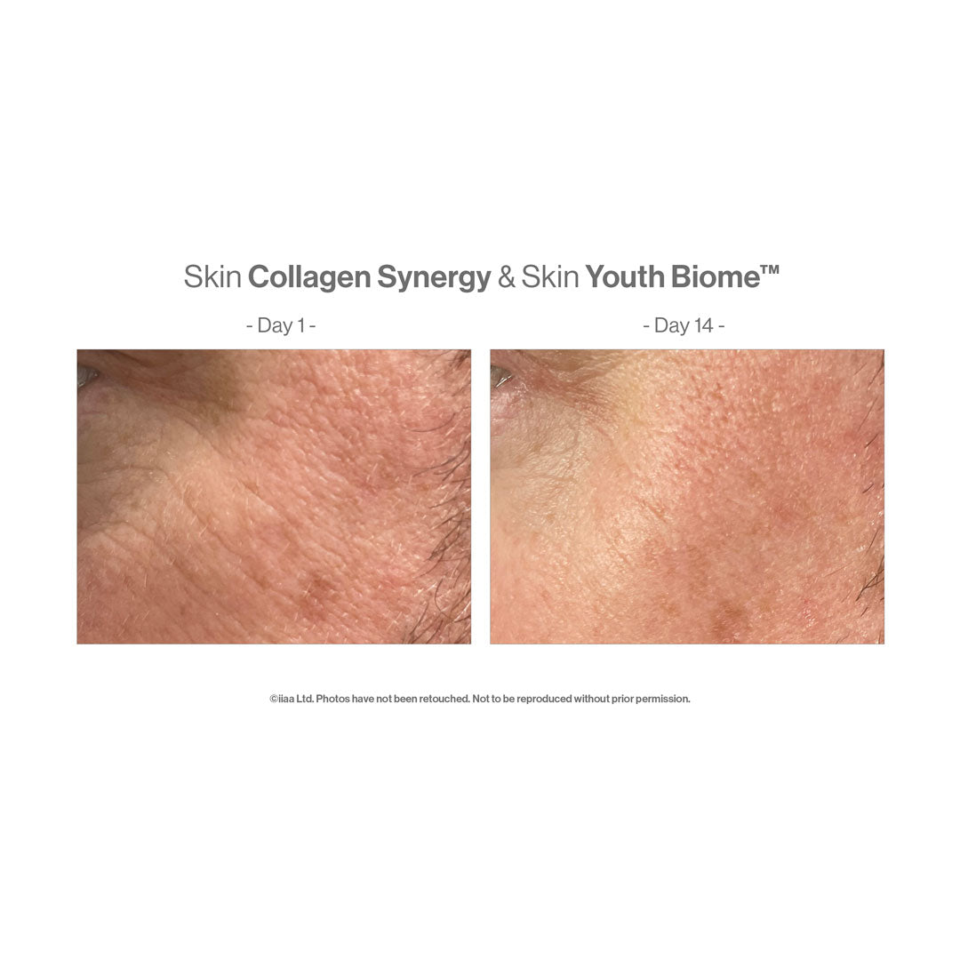 A before and after 14 days of using the product