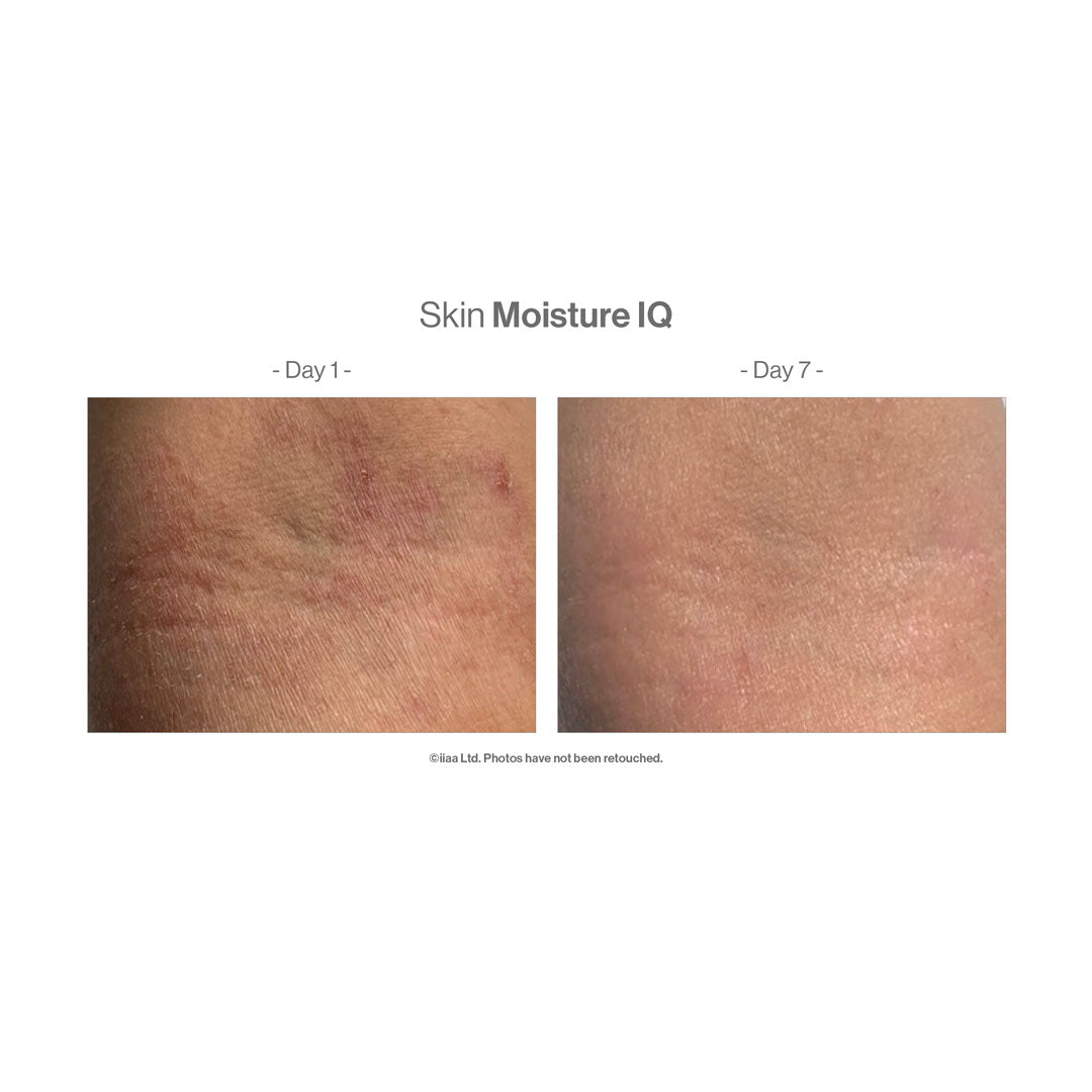 A before and after 7 days of use showing a reduction in skin rashes