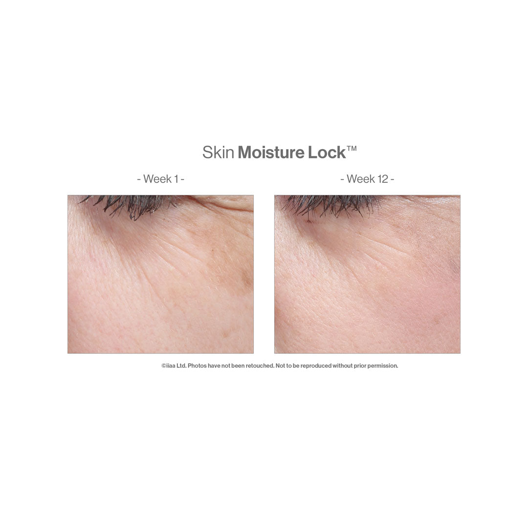 A before and after 12 weeks of use showing an improved skin completion 