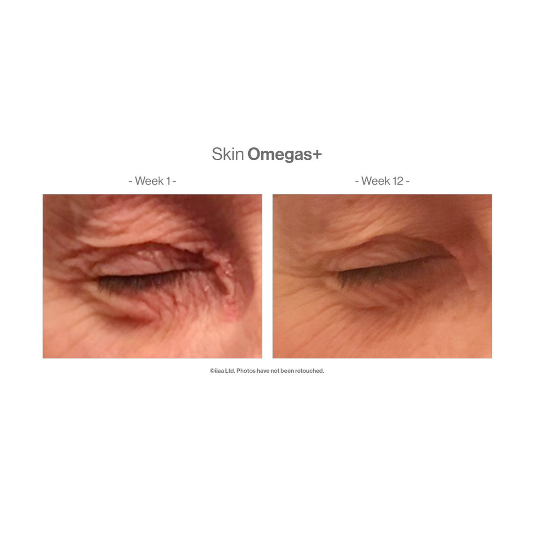 A before and after 12 weeks of using the product revealing an improved skin condition
