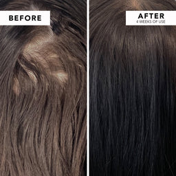 WE ARE PARADOXX Growth Advanced Scalp Serum 50ml before and after